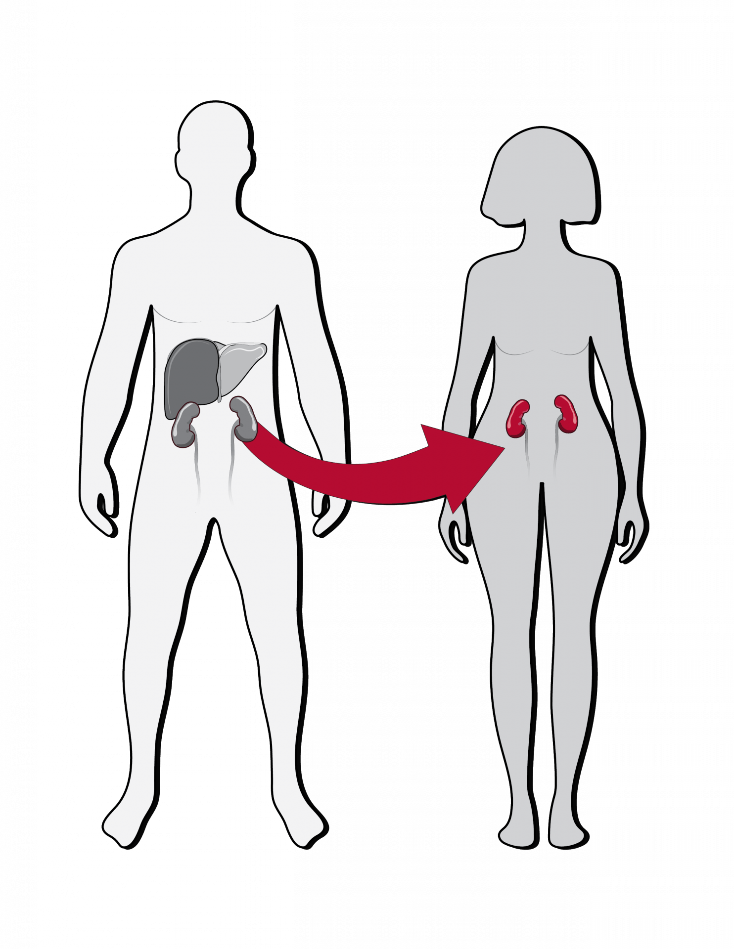 Transplant Surgery | Department of Surgery | Washington University in ...