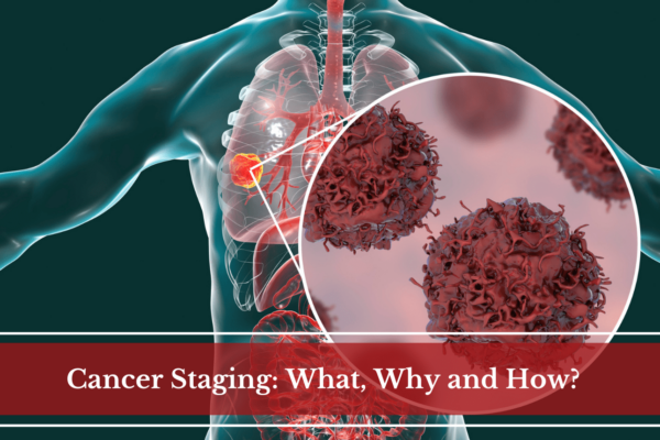 Cancer Staging: What, Why and How?