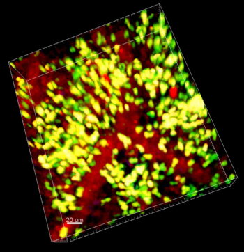 Figure depicting neutrophils infiltrating lung grafts and forming large clusters.