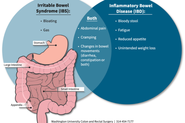 Inflammatory Bowel Disease or Irritable Bowel Syndrome?