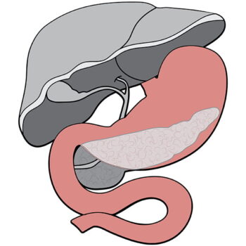 Section of Hepatobiliary-Pancreatic & GI Surgery