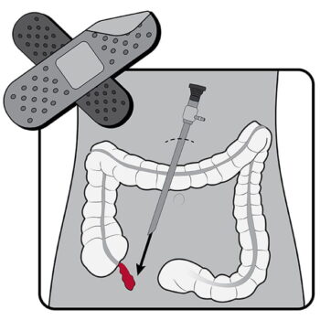 Section of Minimally Invasive Surgery