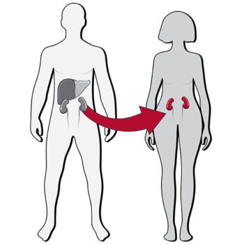 Section of Transplant Surgery