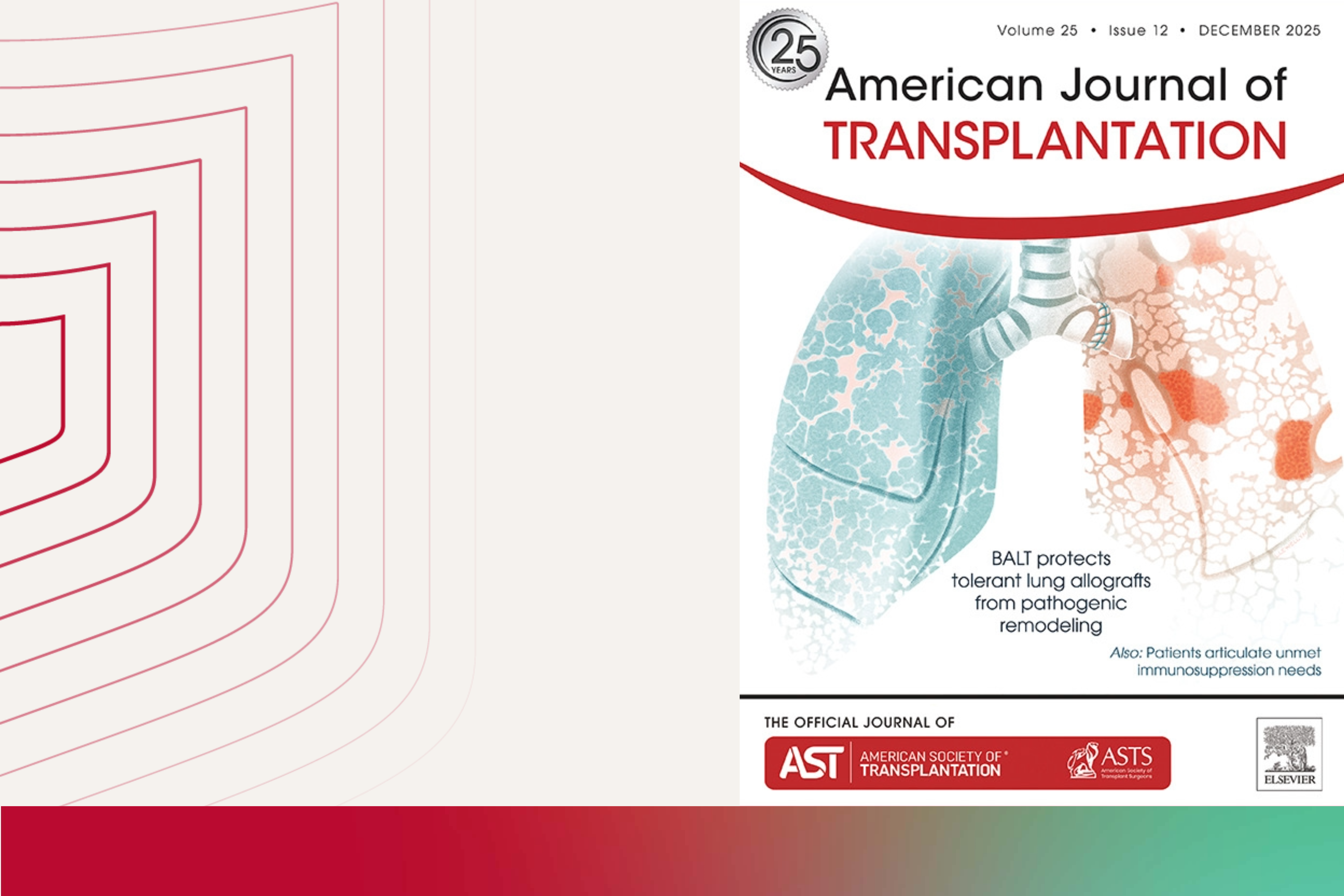 Pivotal advancement achieved in lung transplantation immunity