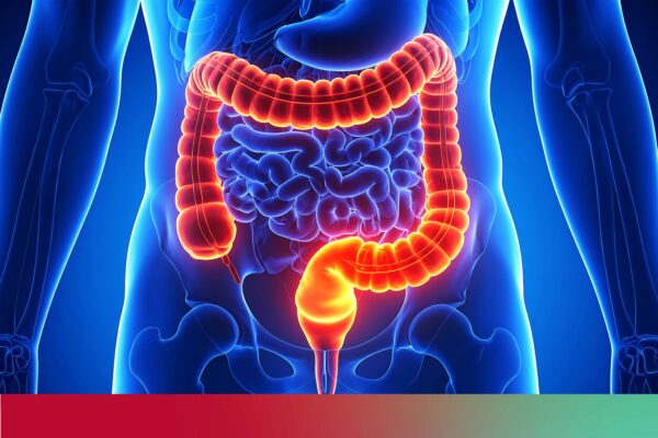 Colorectal cancer awareness: A leading surgeon’s essential insights