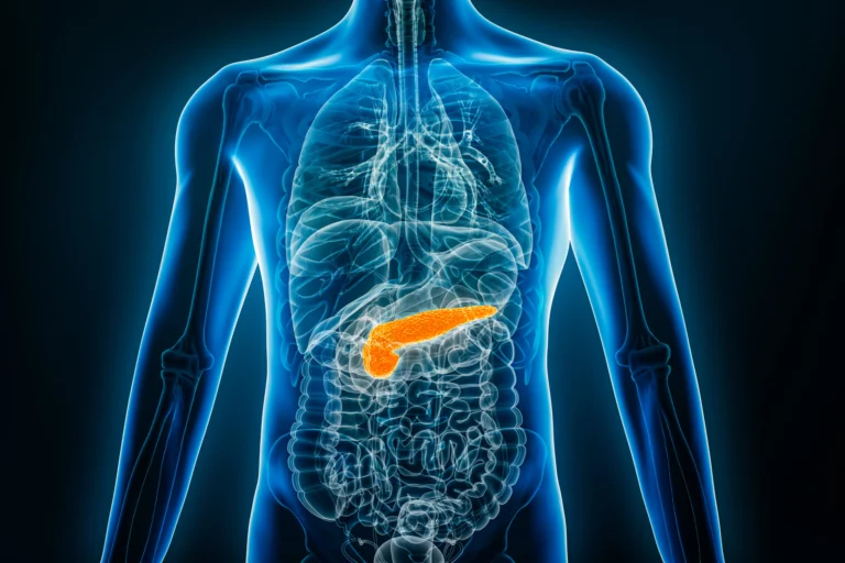 Newly Approved Pancreatic Cancer Treatment Has Been Shown To Prolong Life — And Highlights Siteman’s Role in Bringing Innovation to Patients