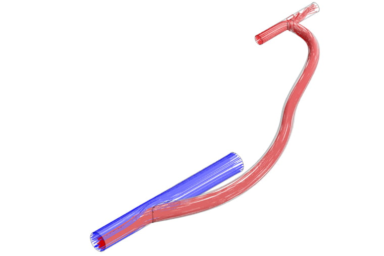 Rendering of an arteriovenous graft. The blue section represents a vein, the short red section an artery and the longer red section, a graft connecting the two. (Image courtesy Mohamed Zayed)