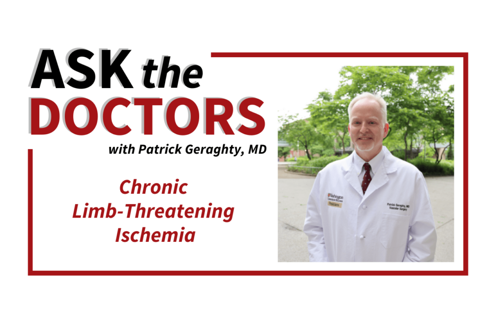 Ask the Doctors Header Image, featuring Patrick Geraghty, MD shown to the right, with Critical Limb-Threatening Ischemia typed to the left.