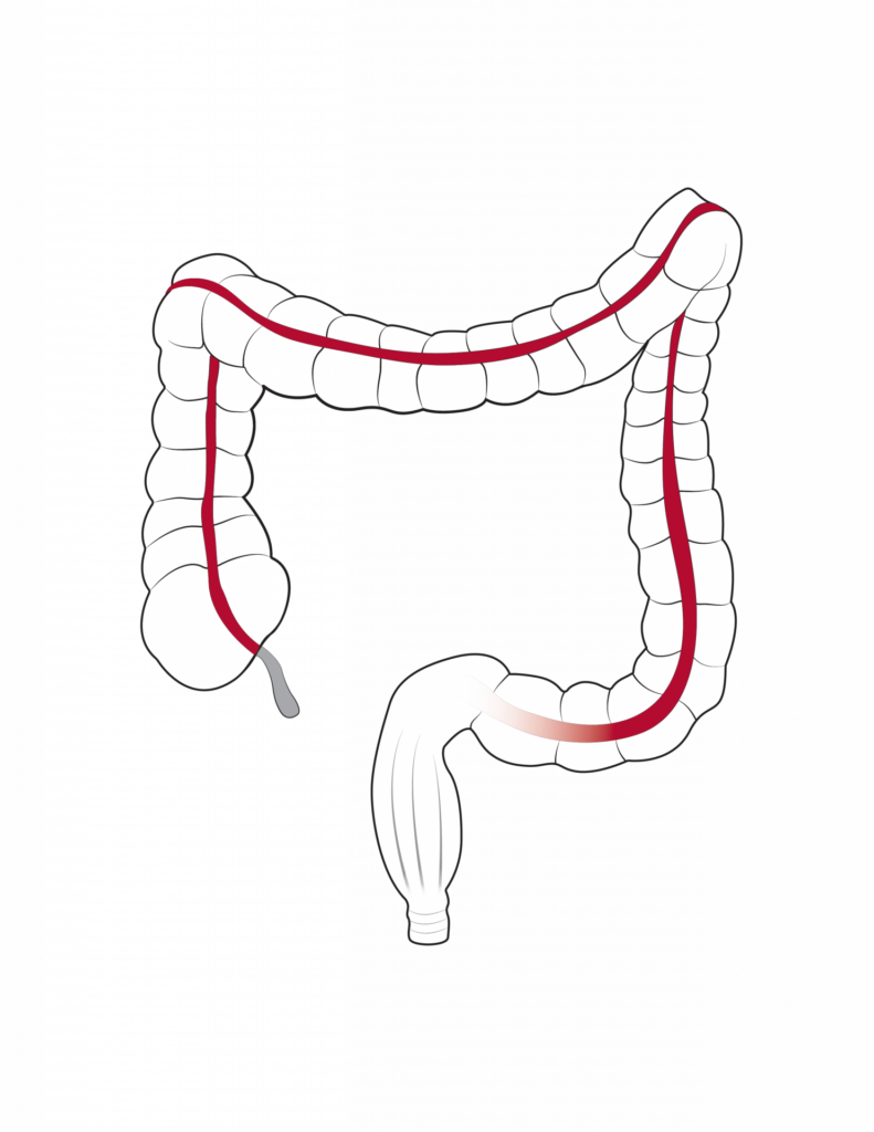 Section of Colon and Rectal Surgery 