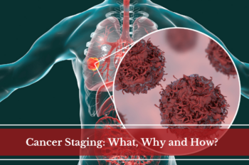 Featured graphic illustration of cancer cells in human lung with text overlay that reads "Cancer Staging: What, Why and How"