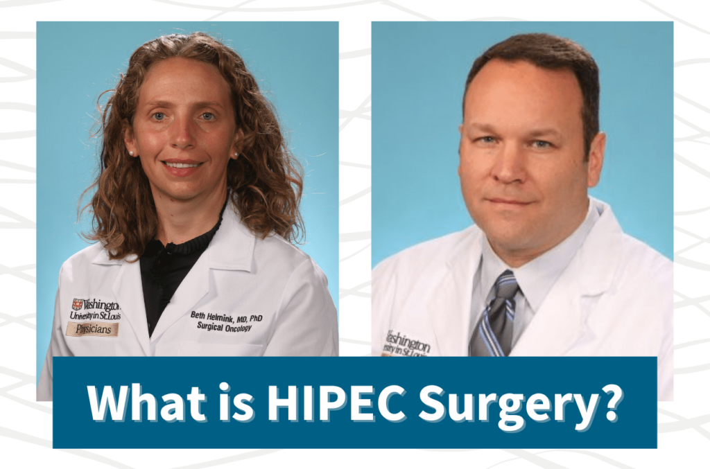 What is HIPEC Surgery?