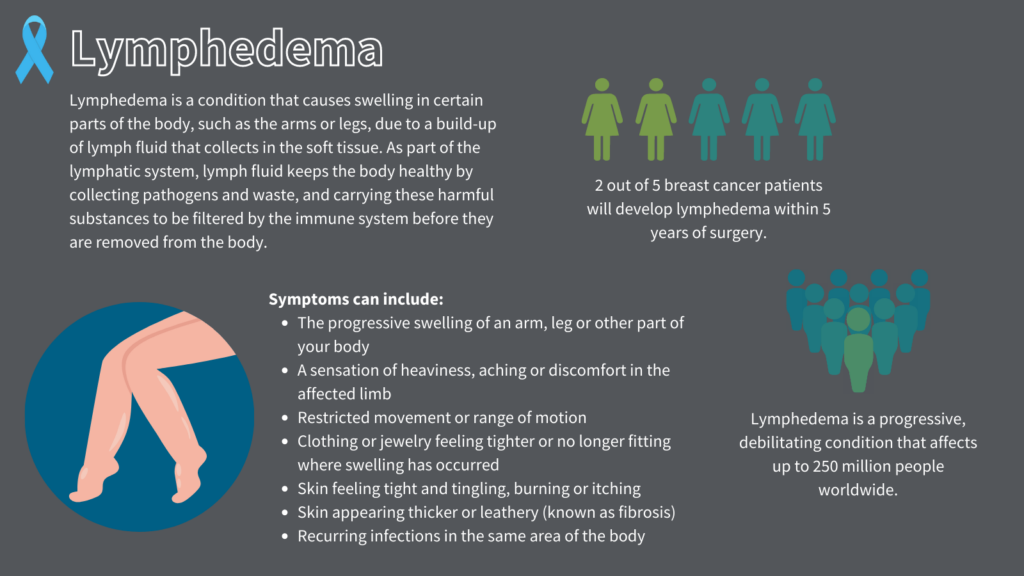 Infographic describing lymphedema, symptoms and prevalence.