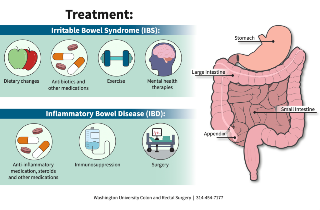 Comparison of IBS and IBD treatments with medical illustration of the digestive system.