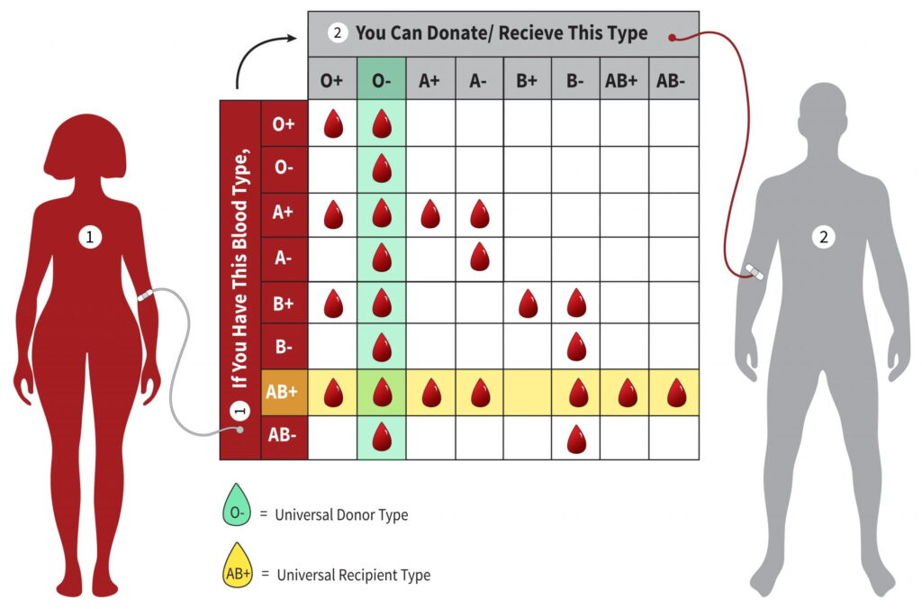 Chart that illustrates the different blood types of blood donor and patient who receives blood, what combinations are suitable for a transfusion.