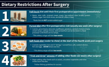 Life After Bariatric Surgery: Activities & Diet | Department Of Surgery ...