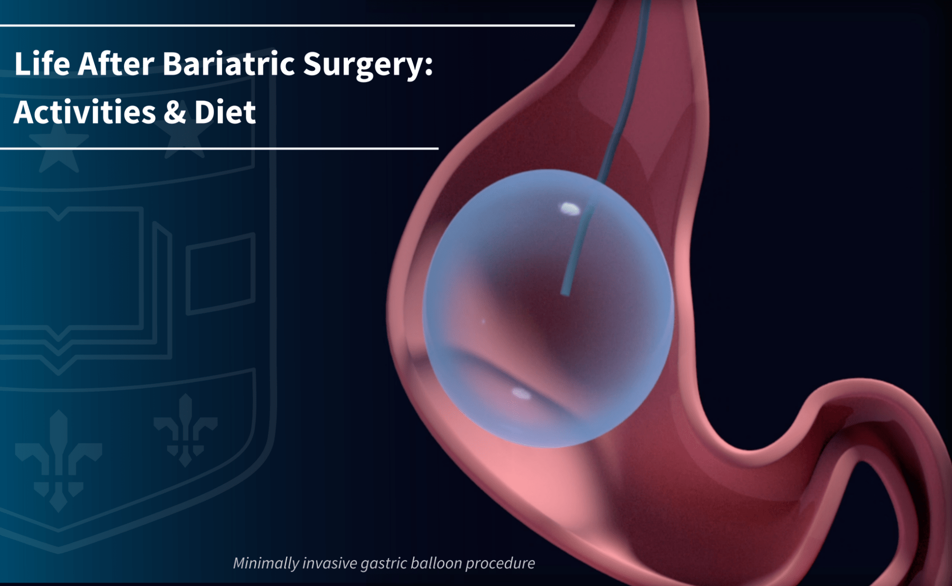 You MUST know this information previously to have a Bariatric Surgery!
