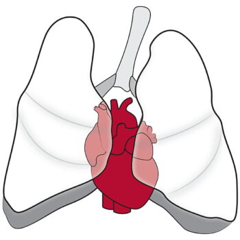 Section of Pediatric Cardiothoracic Surgery